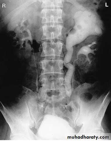 Renal system