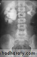 Renal system