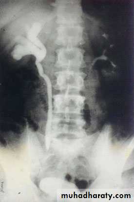 Renal system