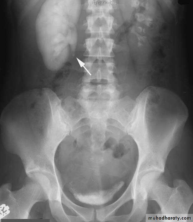 Renal system