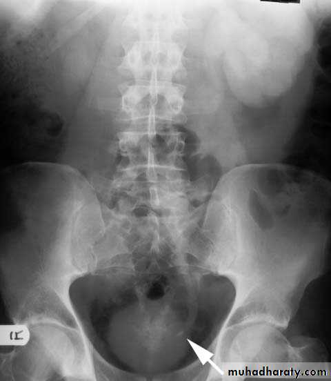 Renal system