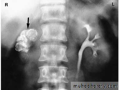 Renal system