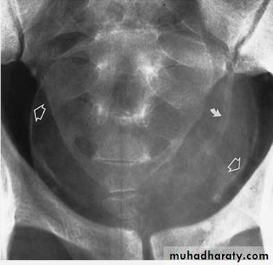 Renal system