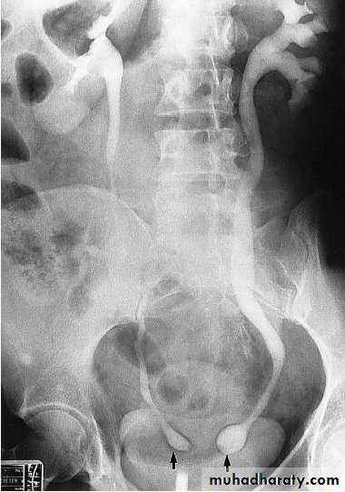 Renal system