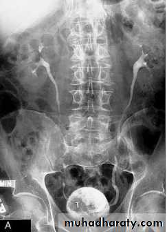 Renal system