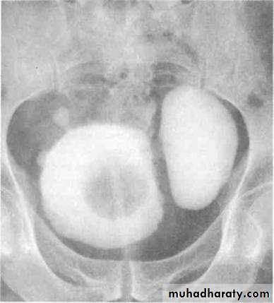 Renal system