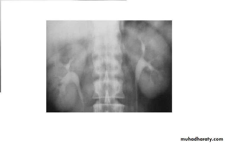 Renal system