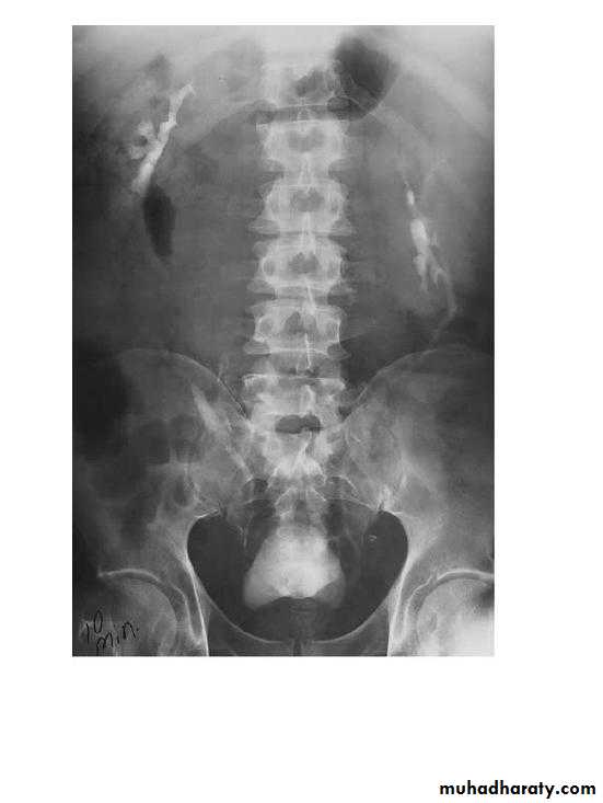 Renal system