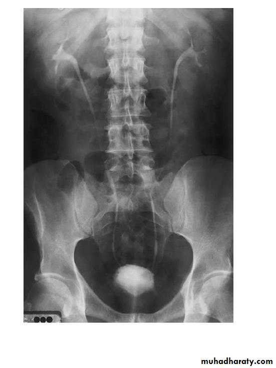 Renal system