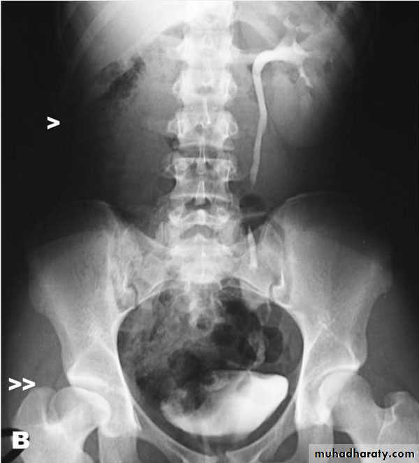 Renal system