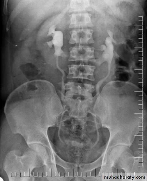Renal system