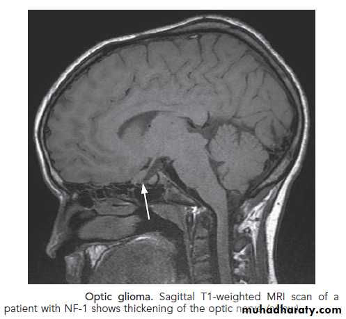 neuro