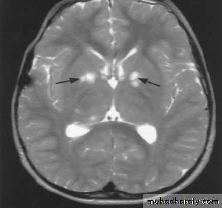 neuro