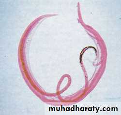 Trematodes The Platyhelminthes (Flatworms)