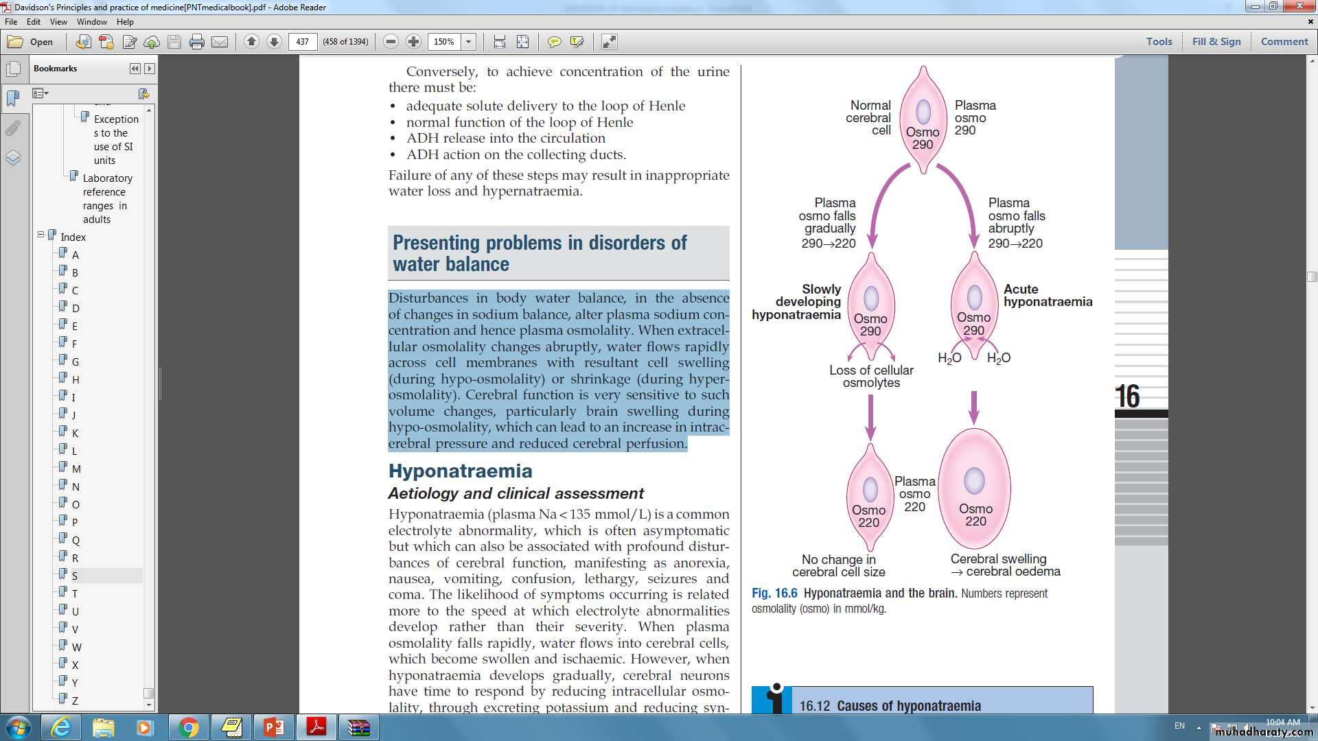 DISORDERS OF electrolytes imbalance