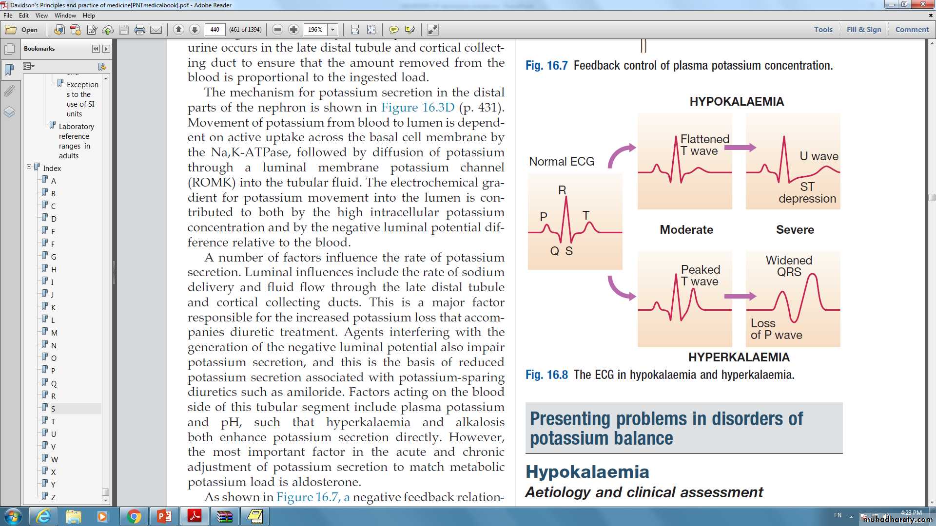 DISORDERS OF electrolytes imbalance
