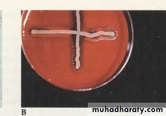 Fastidious Gram Negative Coccobacilli