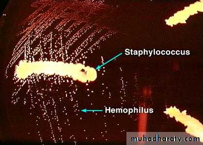 Fastidious Gram Negative Coccobacilli