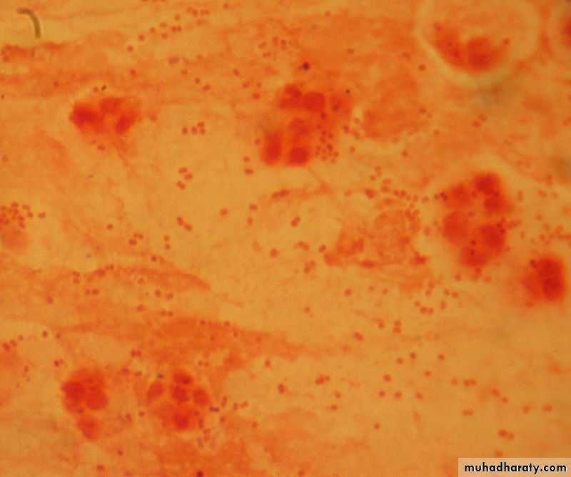Fastidious Gram Negative Coccobacilli