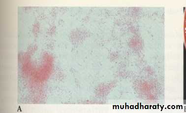 Fastidious Gram Negative Coccobacilli