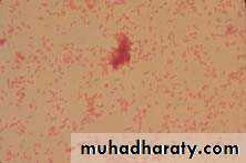 Fastidious Gram Negative Coccobacilli