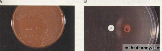Fastidious Gram Negative Coccobacilli