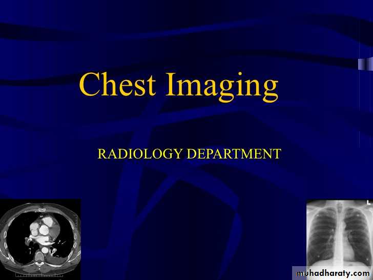 Mediastinum and heart