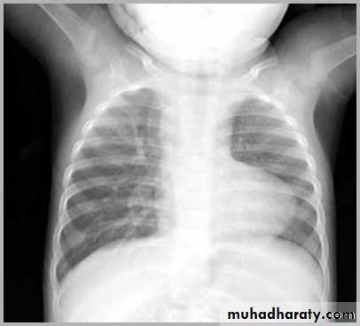 Mediastinum and heart