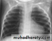 Mediastinum and heart