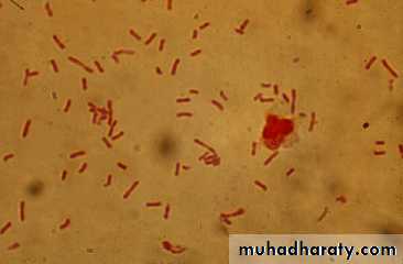 urinary tract infection