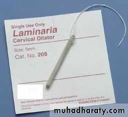 induction of labour