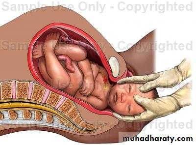prolong pregnancy