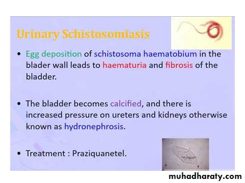 urinary tract infection2