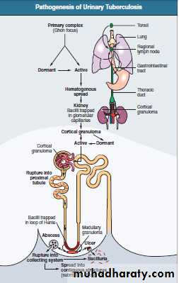 urinary tract infection2
