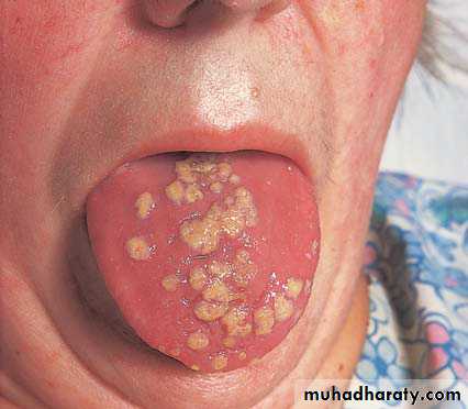 The oral cavity
