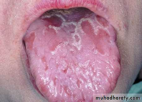 The oral cavity