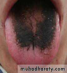 The oral cavity
