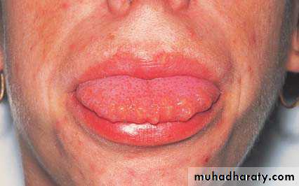 The oral cavity