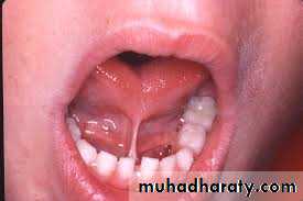 The oral cavity