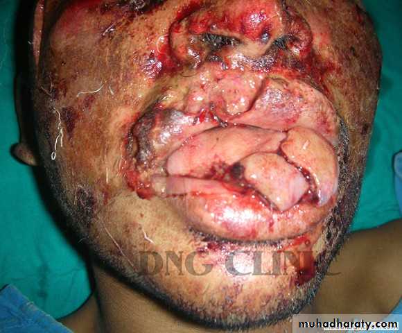 The oral cavity