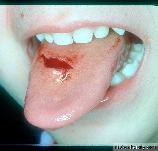 The oral cavity