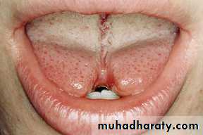 The oral cavity