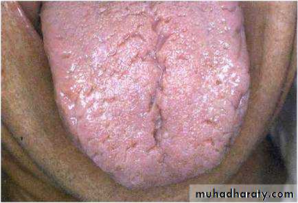 The oral cavity