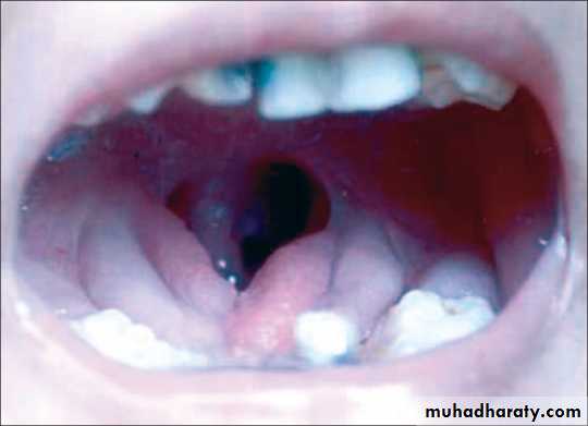 The oral cavity
