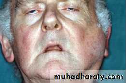 salivary glands