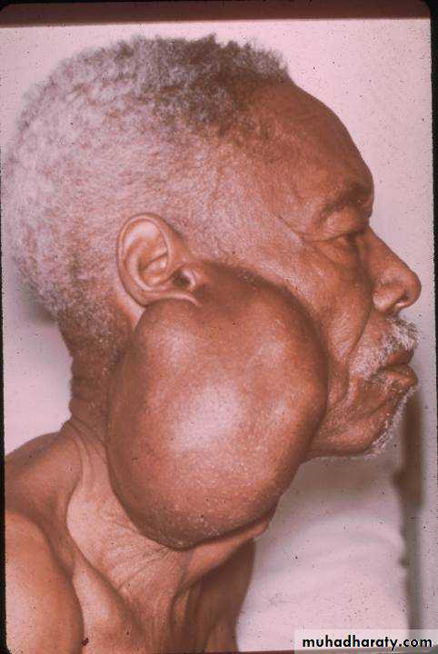 salivary glands