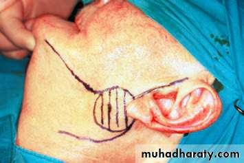 salivary glands