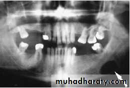 Salivary glands