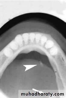 Salivary glands