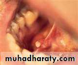 Salivary glands